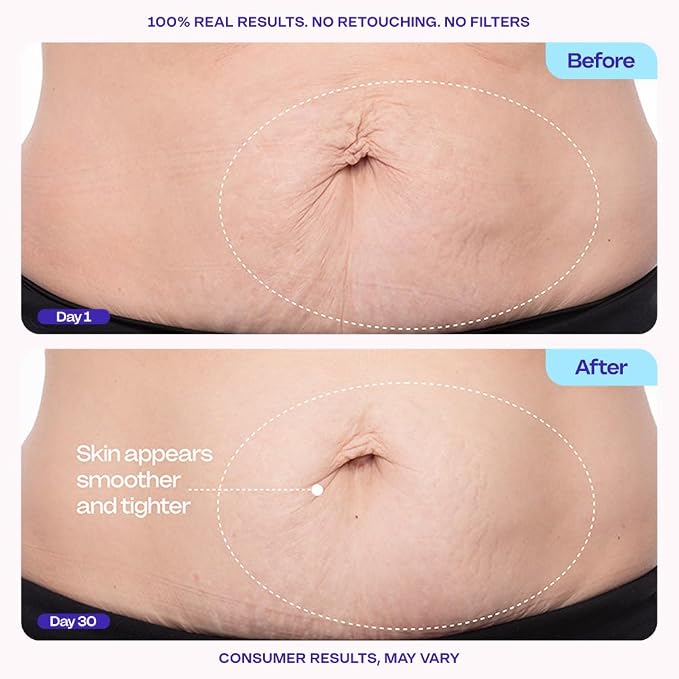 goPure Firming Belly Cream - Image 3