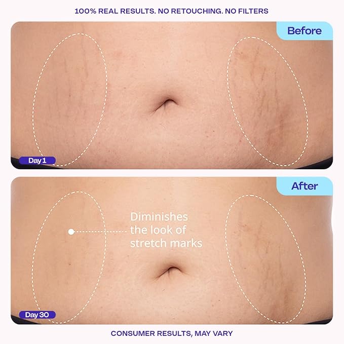 goPure Firming Belly Cream - Image 5