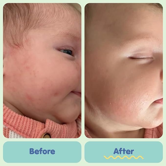 TUBBY TODD All Over Ointment Baby Eczema Cream, Everyday Multi-Purpose Baby - Image 5