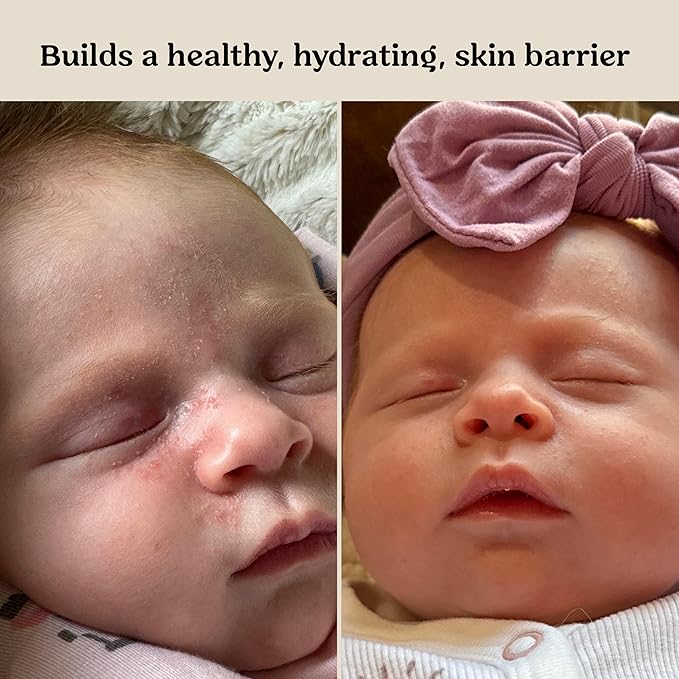 Roe Wellness Baby Cream & Baby Serum Power Pair Biome Barrier | - Image 9